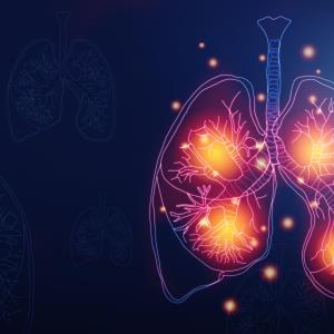 Cemiplimab shows favourable signals as first-, second-line treatment alternative for NSCLC