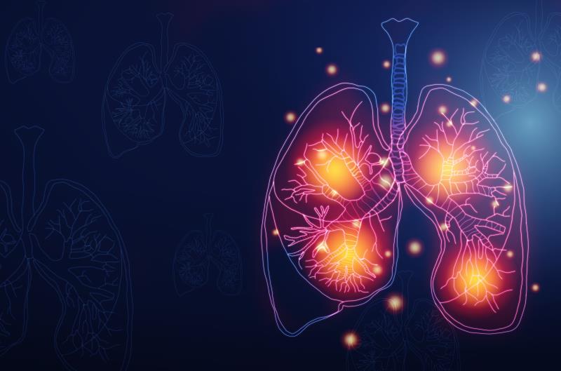 Cemiplimab shows favourable signals as first-, second-line treatment alternative for NSCLC