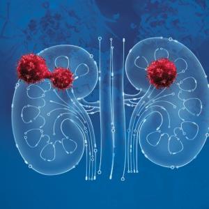 ESMO 2024 Kidney Cancer Puzzles: From Insights to Progress