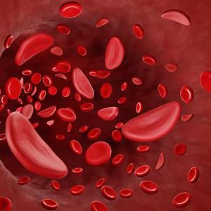 Etavopivat reduces VOCs in patients with sickle cell disease