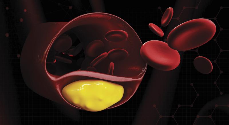 Long-term evolocumab reduces LDL-C in patients with familial hypercholesterolaemia