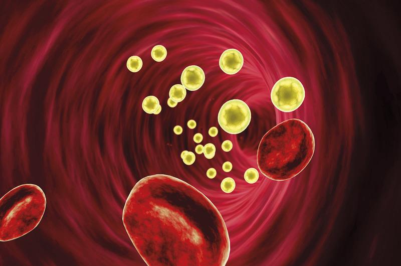 Evolocumab added to high-intensity statins safely lowers LDL-C levels in acute ACS patients