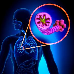 Proteomic profiling of COPD may lead to new treatment strategies