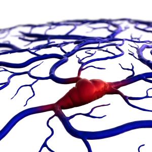 High depressive symptom burden, hypertension up risk of new-onset stroke