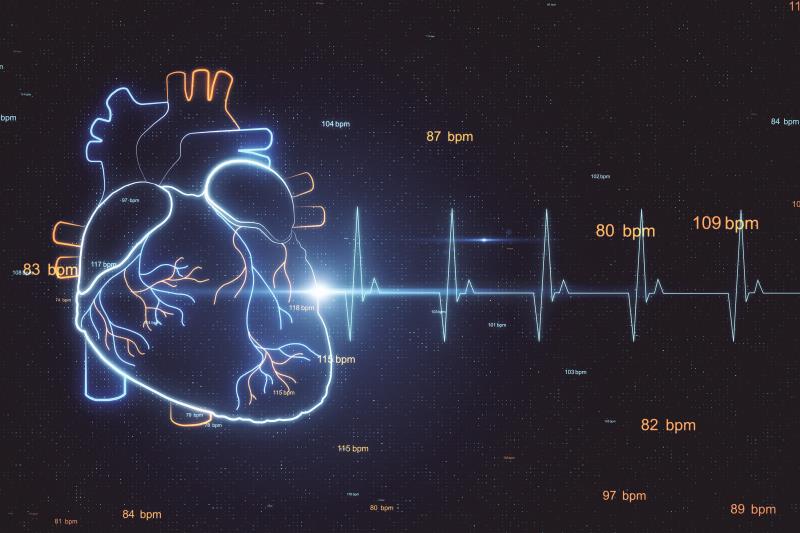 Extended vs standard ECG monitoring detects more arrhythmias in HCM