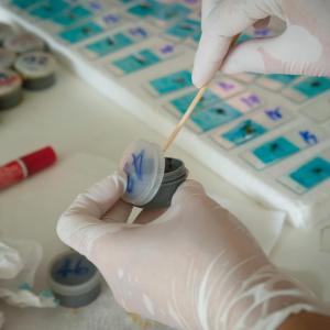 Faecal transplant shows promise in type 1 diabetes