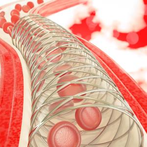 Bioresorbable scaffolds, drug eluting stents perform comparably for long coronary lesions