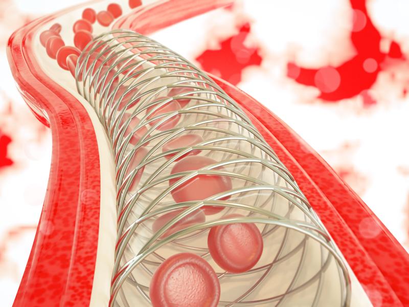 Bioresorbable scaffolds, drug eluting stents perform comparably for long coronary lesions