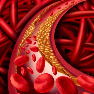 Tryptophan, IPA levels tied to lower mortality in coronary artery disease