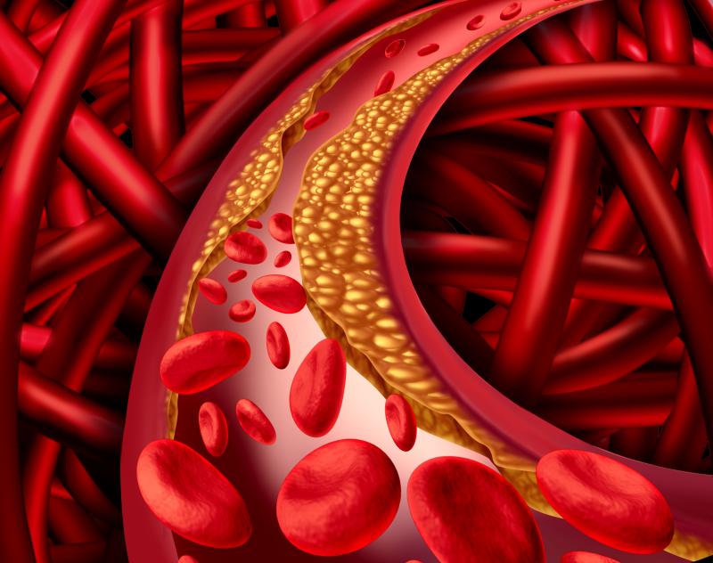 HbA1c tied to coronary artery disease risk