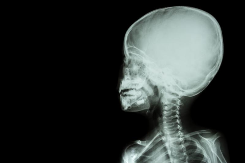 The child’s parents claimed MRI results had revealed their son suffering from brain damage because of the treatment.