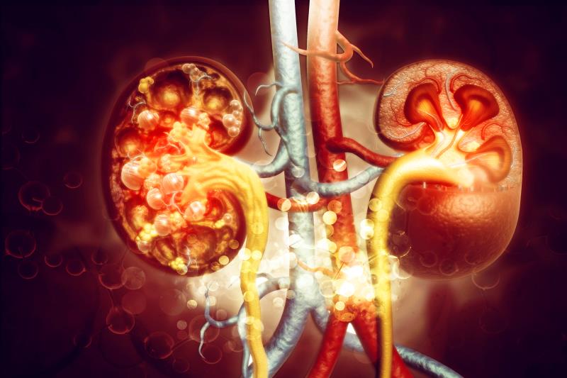 Finerenone reduces CKD progression, CV risk