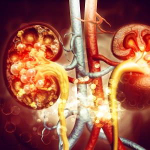 RAS inhibitors more renoprotective than CCBs in advanced chronic kidney disease