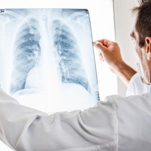 Necitumumab added to first-line chemo improves overall survival in advanced NSCLC