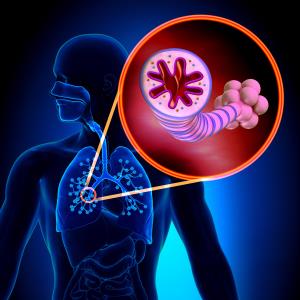 Fixed-dose albuterol/budesonide an effective rescue med in moderate-to-severe asthma