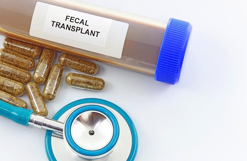 FMT eases anxiety, sleep disturbance in postacute COVID-19 syndrome patients