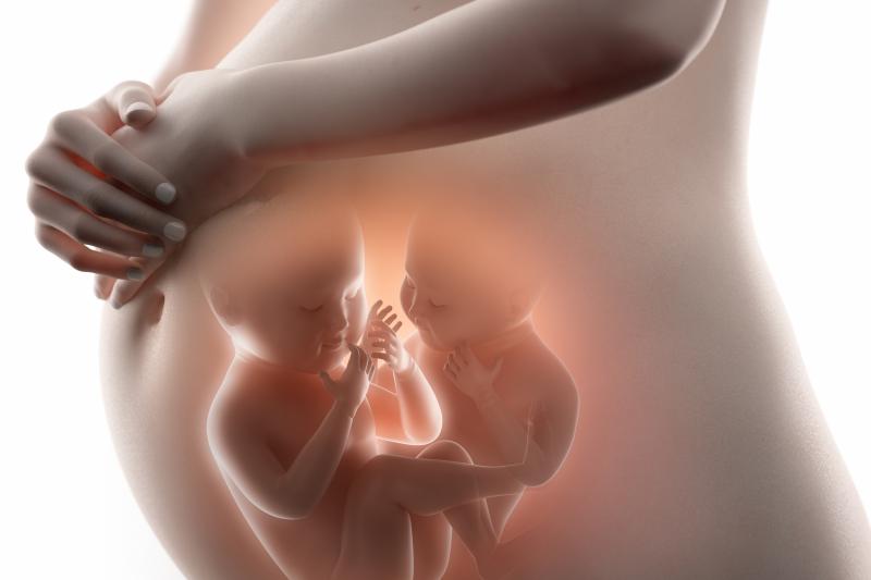 Delayed interval delivery in multiple pregnancy improves survival of foetuses