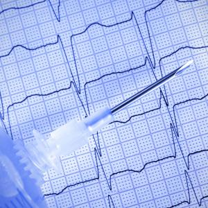 Burden of microvascular disease elevates atrial fibrillation risk in T2D patients