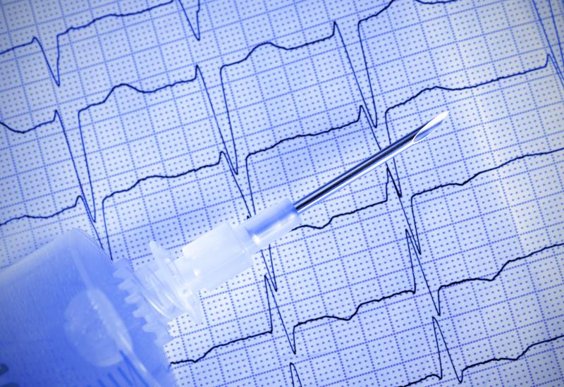 Burden of microvascular disease elevates atrial fibrillation risk in T2D patients