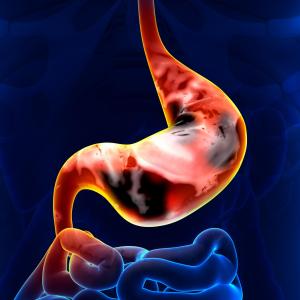 Nine metabolic biomarkers can detect gastric cancer