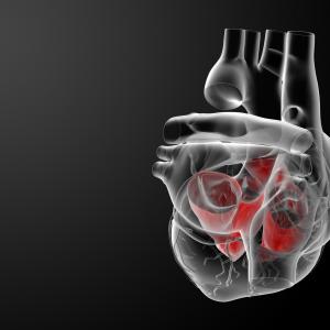 Moderate-to-severe aortic stenosis tied to poor survival when left untreated