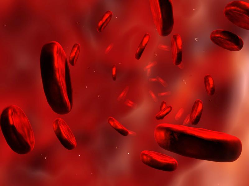 Anaemia negatively impacts QoL in CKD patients