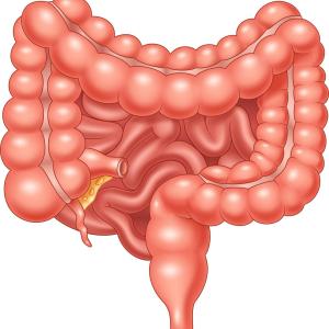 Small bowel adenocarcinoma in coeliac disease: Is the risk real?