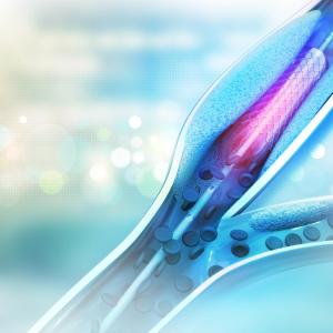 DCB angioplasty vs DES implantation: Which is better in coronary stent restenosis?