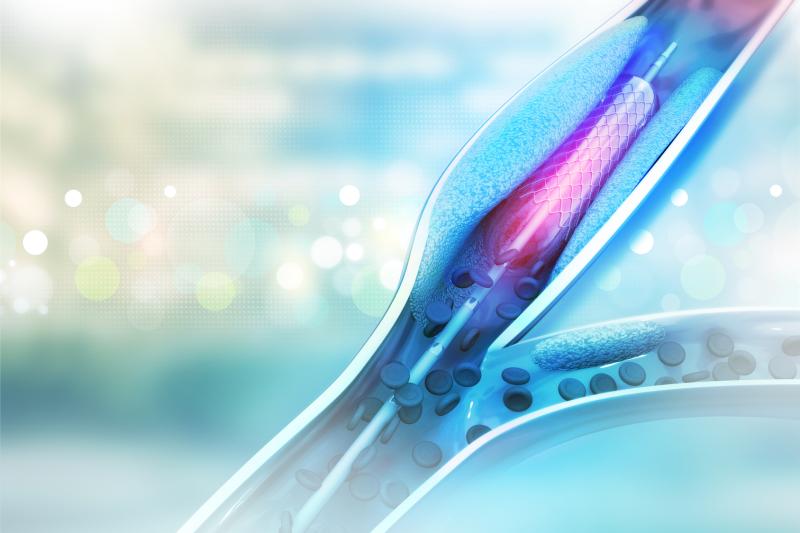 DCB angioplasty vs DES implantation: Which is better in coronary stent restenosis?