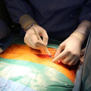 Povidone iodine noninferior to chlorhexidine gluconate for preventing surgical site infections