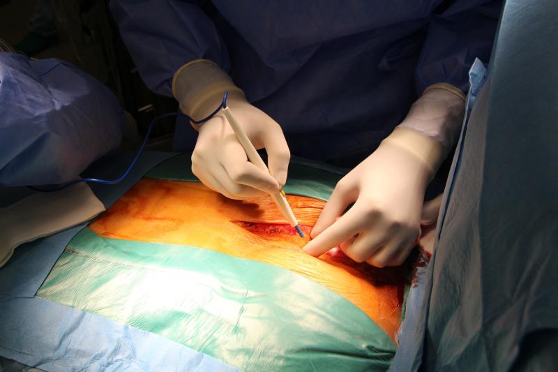 Povidone iodine noninferior to chlorhexidine gluconate for preventing surgical site infections
