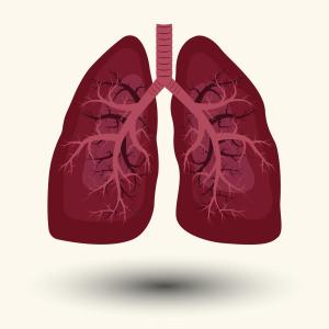 Transient asymptomatic pulmonary opacity frequently seen in osimertinib-related pneumonitis