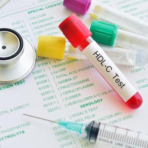 High HDL-C concentrations up CVD risk regardless of diabetes status