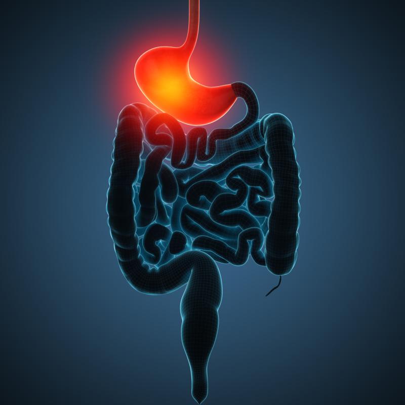 Neoadjuvant chemoradiation outperforms chemo alone for oesophageal squamous cell carcinoma