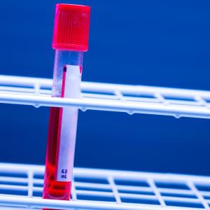 B-FAST: Blood assay test for ALK-targeted therapy makes the grade in lung cancer