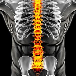 Radicular pain, weak extremities predict poor outcomes in lumbar disc herniation