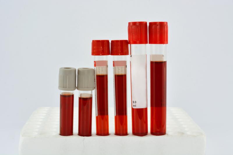 Risk management program cuts plasma triglycerides in T2D