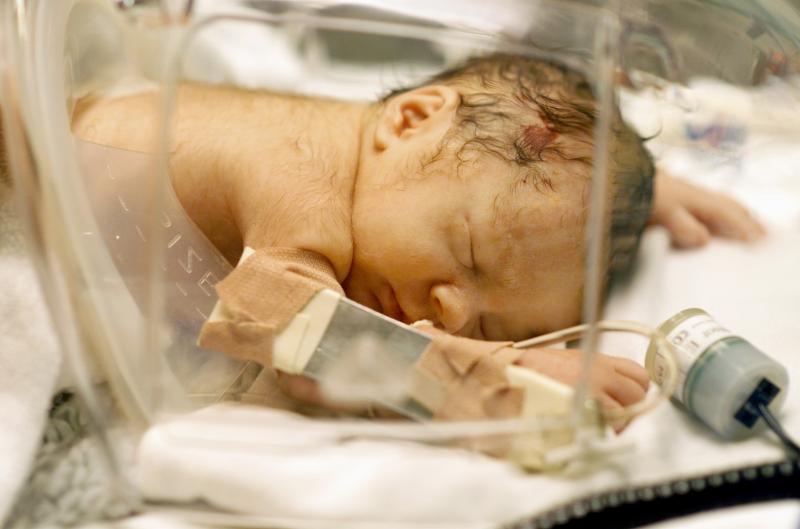 Family history, breech presentation predict developmental dysplasia of hip in early life