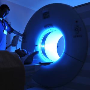 Radiotherapy bears no increased contralateral breast cancer risk among smokers