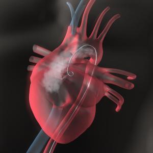 RAS inhibitors help prevent adverse cardiovascular outcomes after CABG