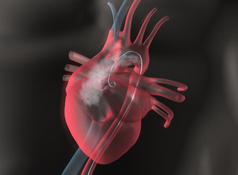 RAS inhibitors help prevent adverse cardiovascular outcomes after CABG