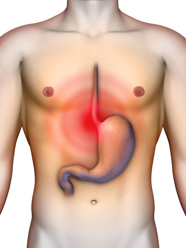 Long-term maintenance vonoprazan beneficial for PPI-resistant reflux oesophagitis