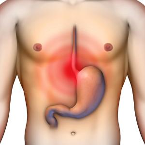 High acid exposure on reflux testing tied to chronic rejection after lung transplant