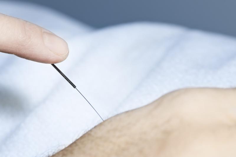 Electro-acupuncture delivers in knee osteoarthritis