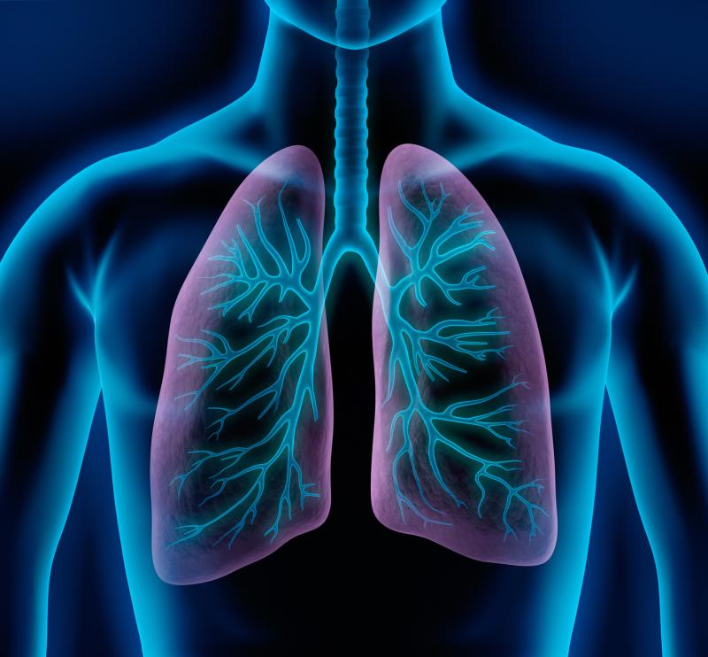 Lorlatinib shows therapeutic potential in advanced ROS1-positive NSCLC