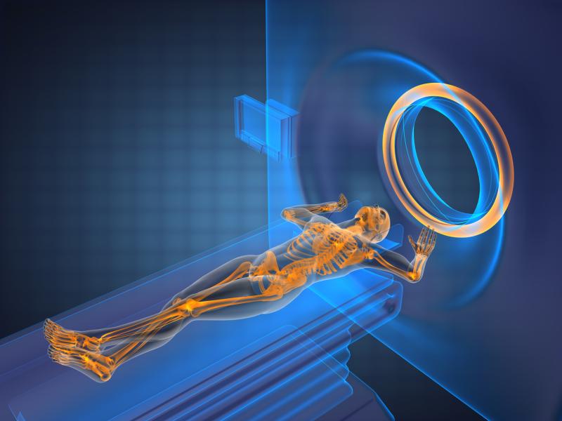 MRI- vs CT- guided radiotherapy for localized prostate cancer linked to lower toxicity, symptom burden