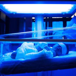 Outpatient management of jaundice needed to lessen paediatric ED visits