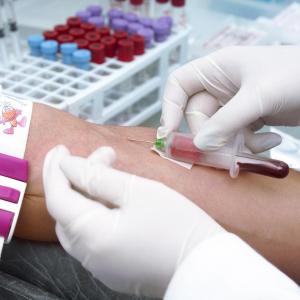 Muscle loss persists in leukaemia patients on nutrition therapy