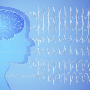 Fenfluramine helps minimize day-to-day seizure burden in Dravet syndrome