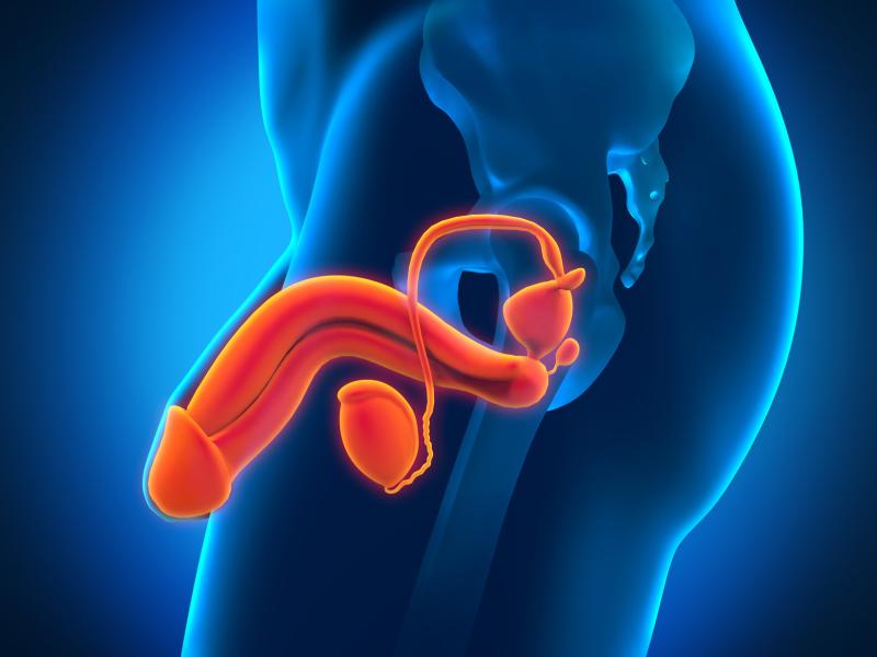 Verapamil reduces penile curvature, plaque size in Peyronie’s disease